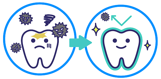 フッ化物歯面塗布