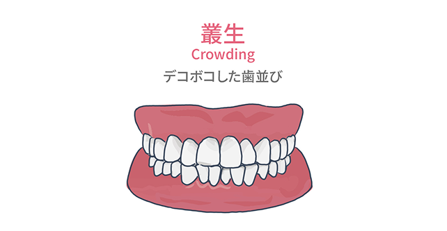 叢生