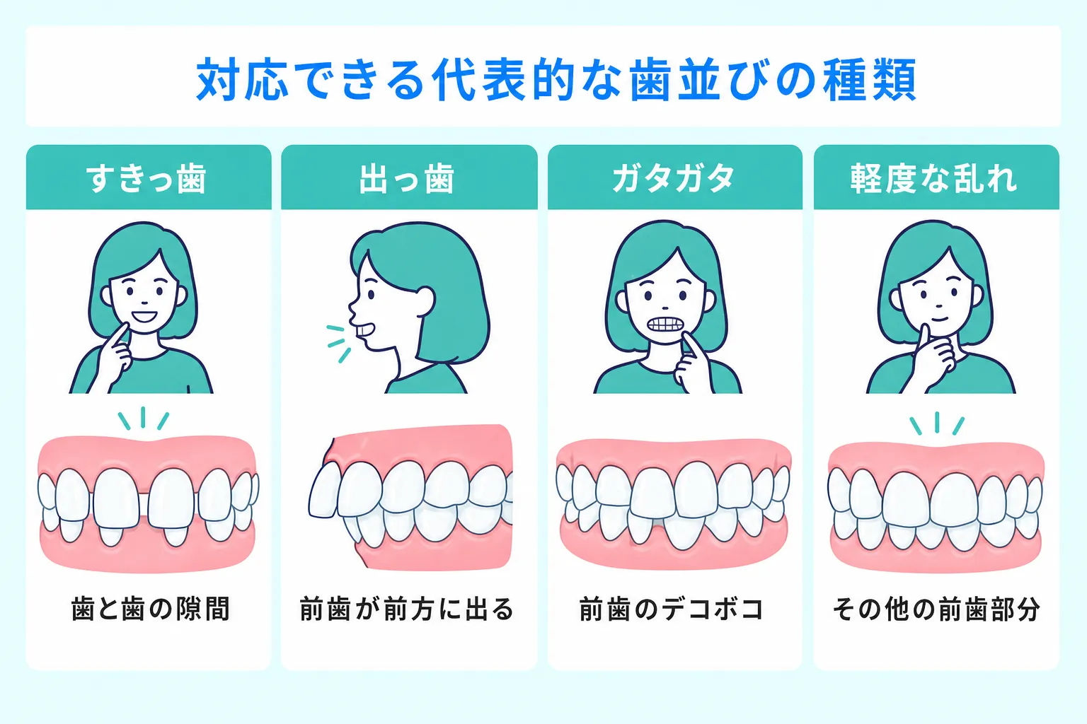 キレイライン矯正が対応できる歯並び