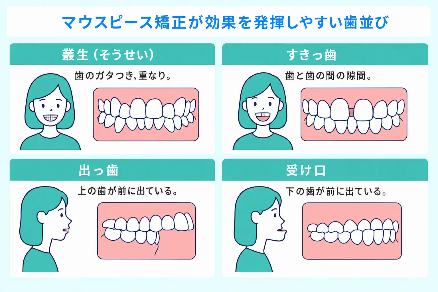 マウスピース矯正の効果の出やすい歯並び