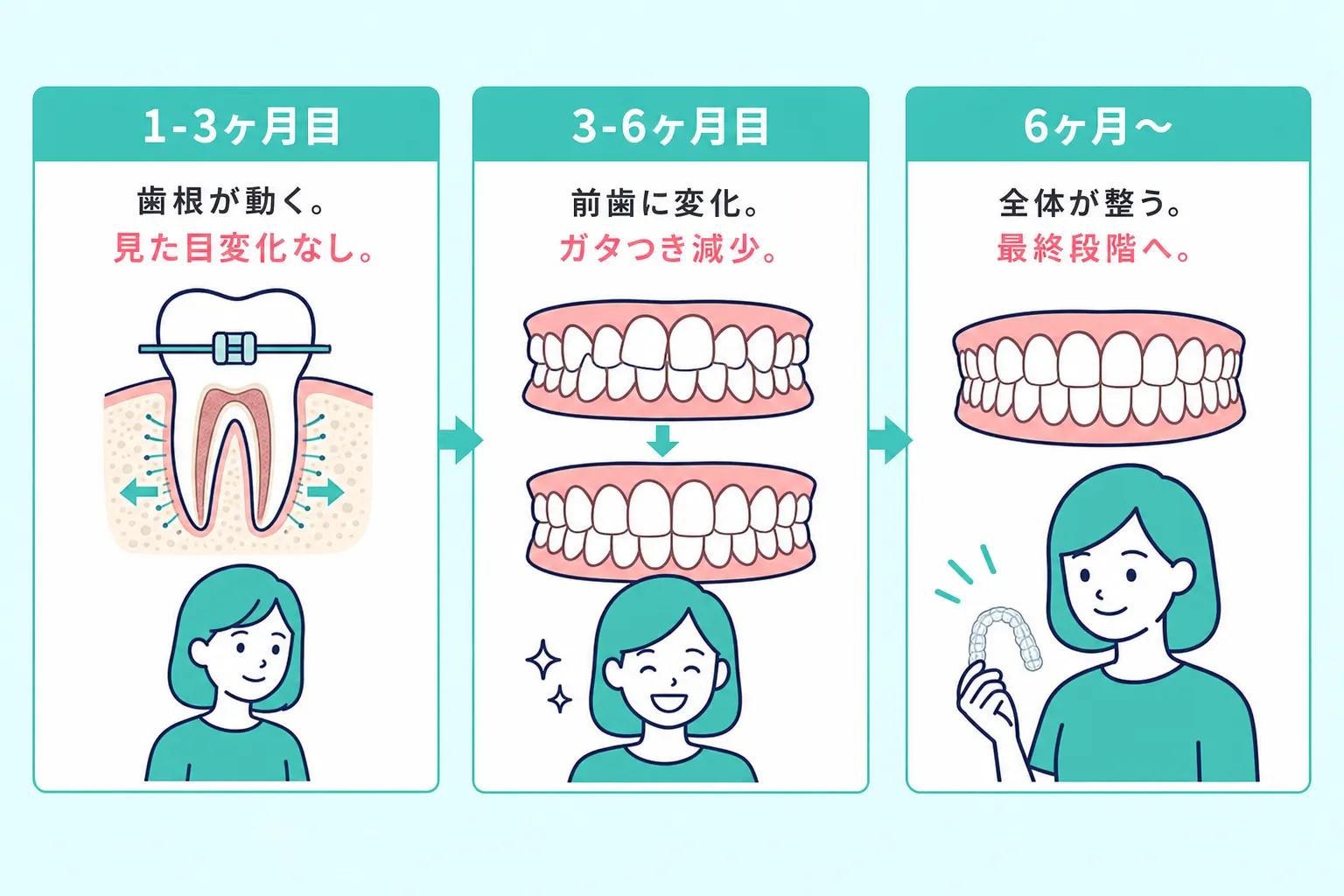 マウスピース矯正の期間ごとの効果の出方
