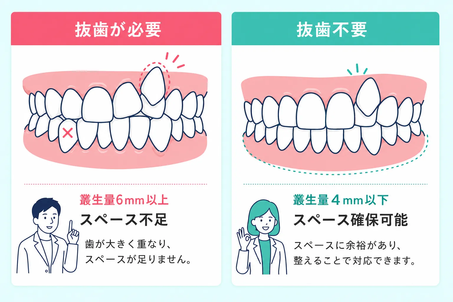 八重歯の矯正で抜歯が必要かどうか