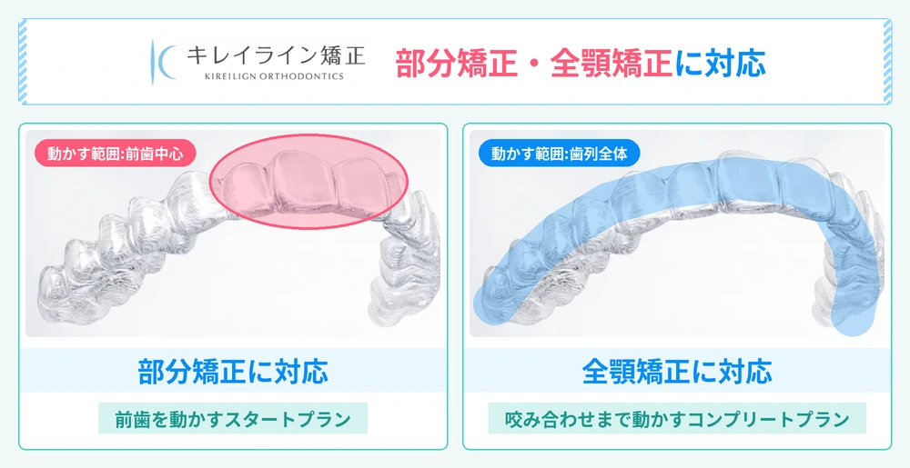キレイライン矯正のマウスピースの特徴