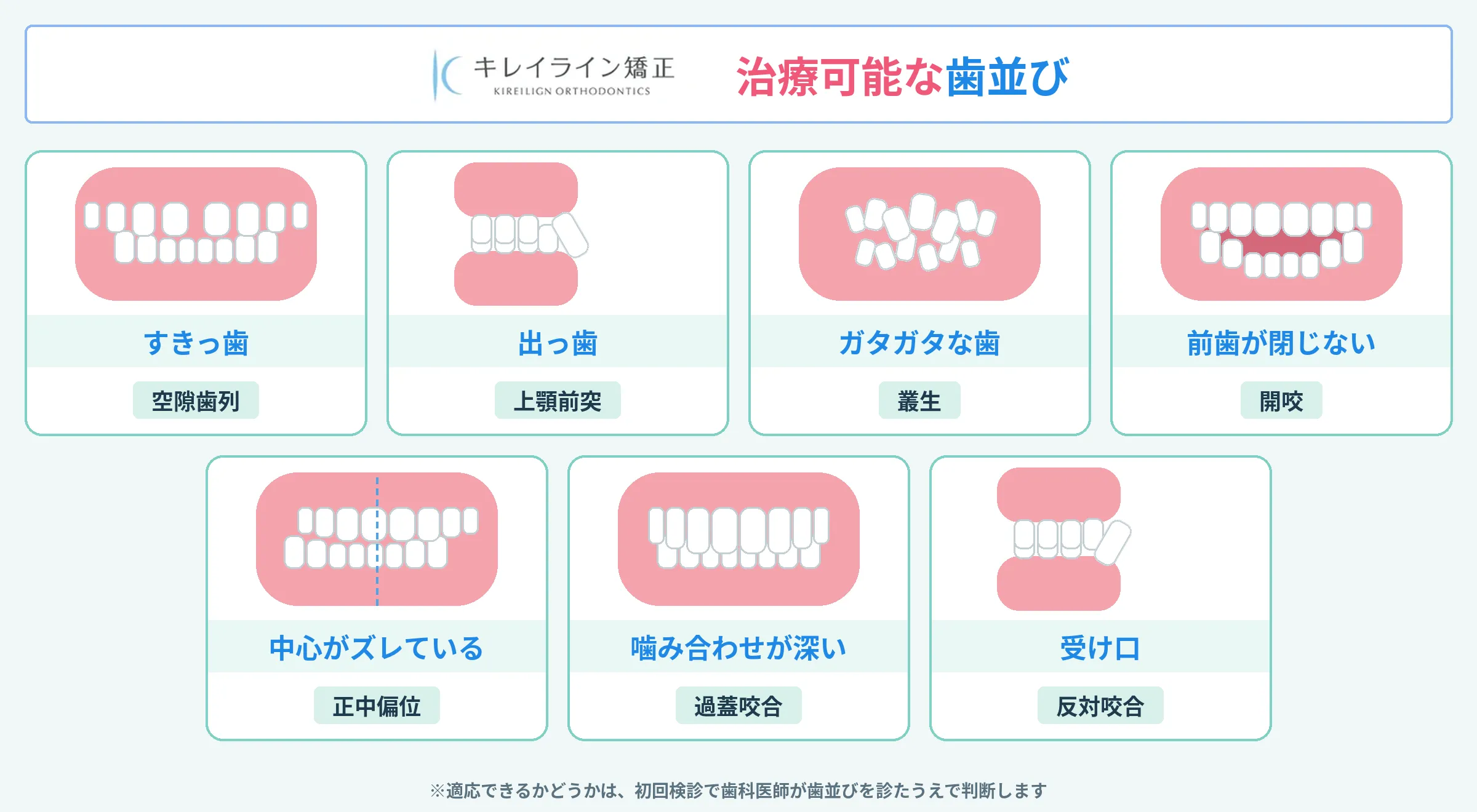 キレイライン矯正で治療できる歯並び