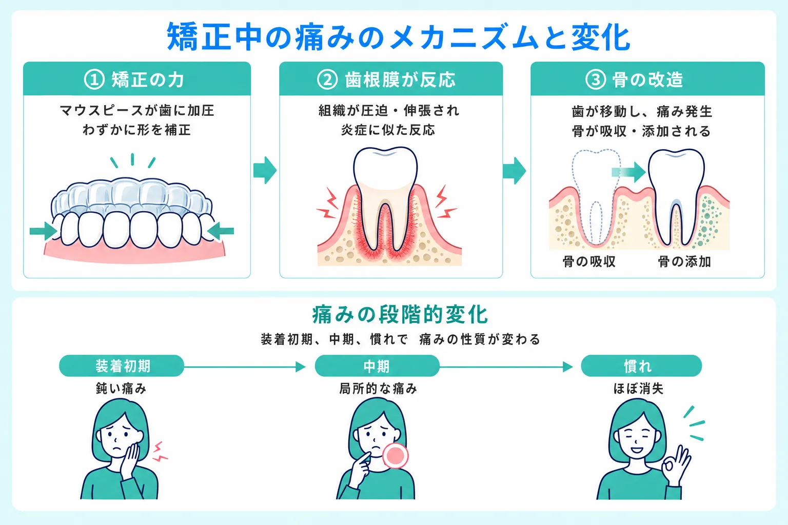 マウスピース矯正で痛みが発生する理由とその段階的な変化を解説