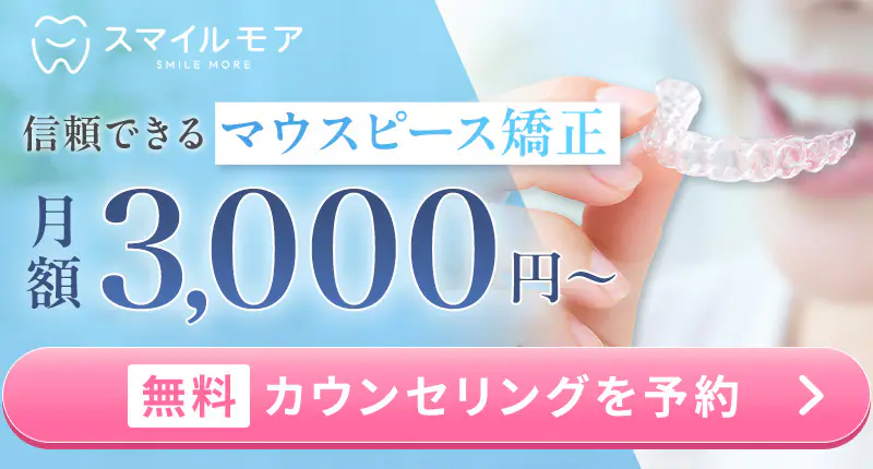 スマイルモア矯正でマウスピース矯正を始めてみる