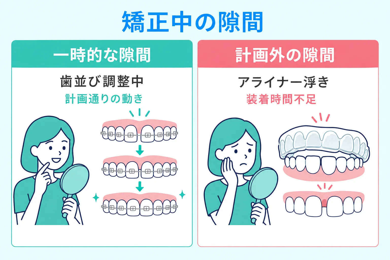 マウスピース矯正ですきっ歯になる原因は装着時間不足があることを説明